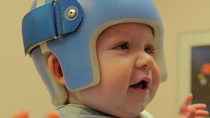 Gavin Metzger, the 7-month-old son of Post-Gazette reporter Paula Reed Ward, looks at his mother while waiting for adjustments to be made to his helmet.
